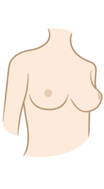 Breasts Surgery
