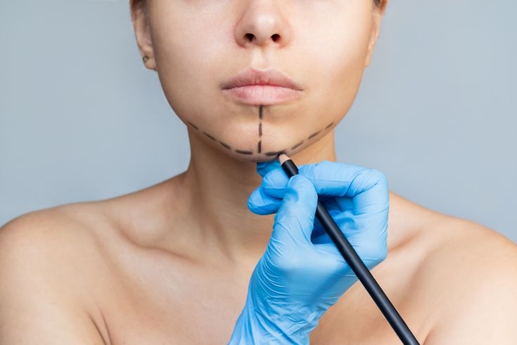 Common Myths About Plastic Surgery Debunked