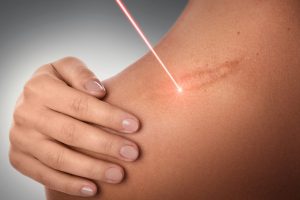 How Surgical Scars Heal: Tips for Better Results