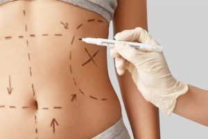 Understanding Body Contours and Shape Correction Through Surgery