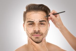 Understanding Facial Structure and Surgical Refinement