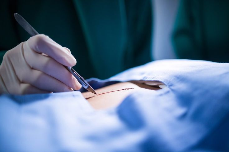 A Long-Form Look at Surgical Safety and Medical Standards