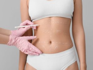 Skin Tightening Without Surgery