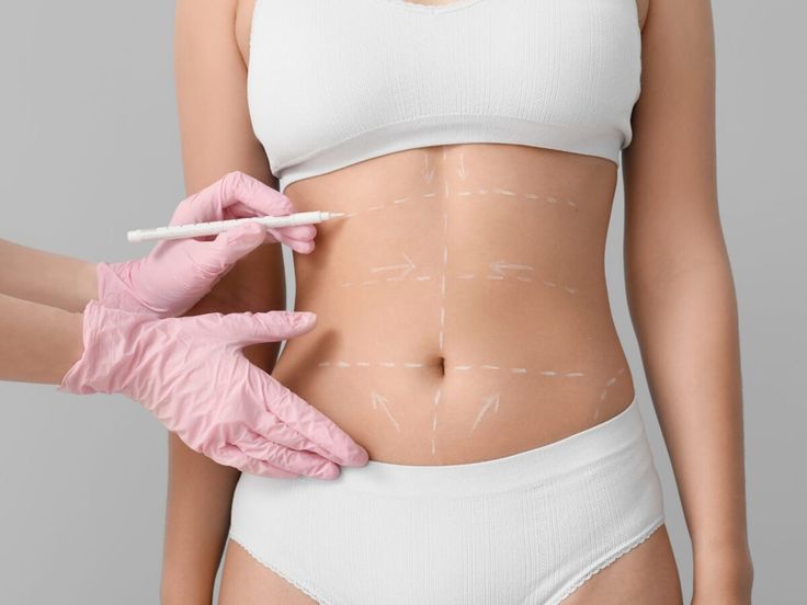 Skin Tightening Without Surgery