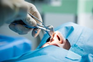 How Plastic Surgery Has Evolved Over the Years