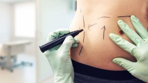 Understanding Upper and Lower Body Enhancement Concepts