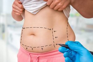 Understanding Surgical Enhancement Across Different Body Types
