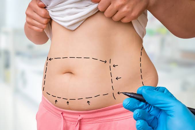 Understanding Surgical Enhancement Across Different Body Types