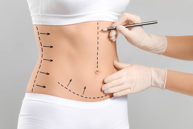 Natural-Looking Results in Body Contouring