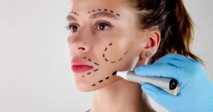 How to Prepare Yourself Before Aesthetic Surgery