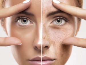How Age and Lifestyle Affect Skin Quality