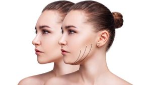 How Chin Shape Affects Facial Balance