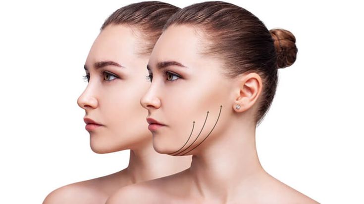 How Chin Shape Affects Facial Balance
