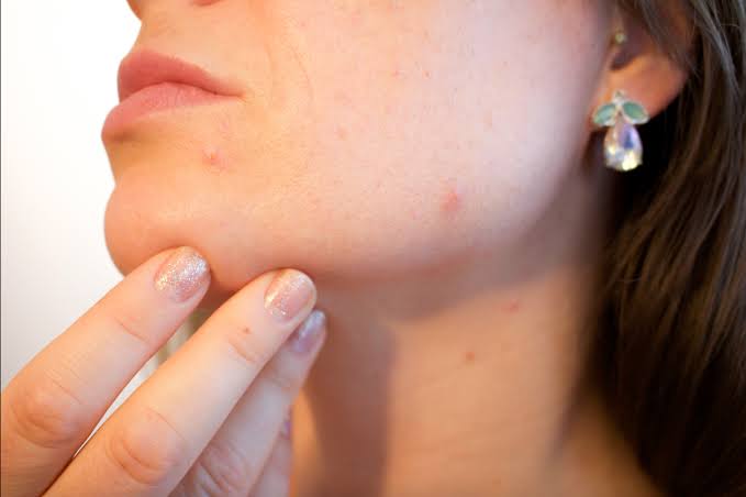 How Hormones Can Influence Skin Changes